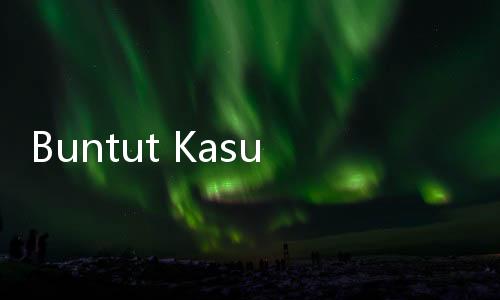 Buntut Kasus Pemerkosaan di RSHS Bandung, Kemenkes Bekukan PPDS Anestesi Sebulan